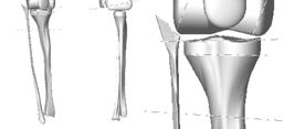 These elements were defined when the bone components of the human knee joint were generating in the CAD environment.