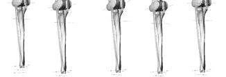 F(t) in femur bone walking 5) The function for reaction force from tibia bone made by the contact between the foot and the ground will be found if the simulation will work properly (using the