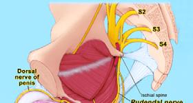 uncertain results Pundendal nerve block A somatic nerve which is a large branch of the sacral plexus