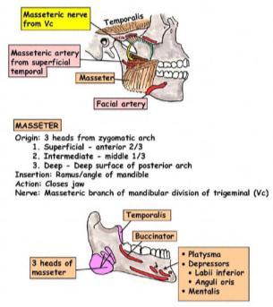 The external carotid artery leaves the sheath when the common carotid artery bifurcates.
