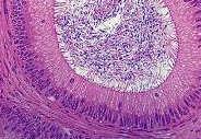 stereocilia (long microvilli)