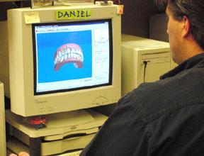Planning Tooth Movements Patient s PVS impressions transformed into 3-D images Clincheck software utilizes treatment form to generate
