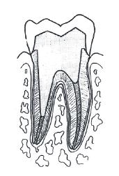 premolars In