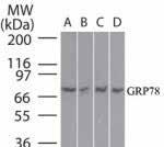 However, may be detected at approximately 90 kda in Western blot, as the protein often undergoes glycosylation, forming the p90 version of.