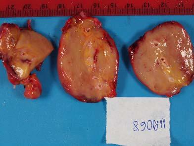 Appendectomy sample. Figure 8.