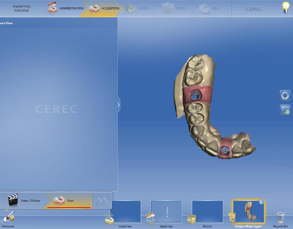 Users wishing to continue with Sirona s recommended workflow, continue reading below. The opposing jaw and buccal bite scans can be taken at any time.