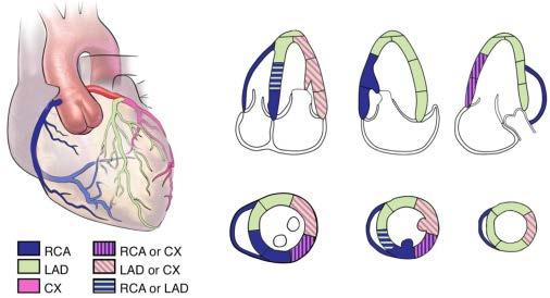 dày giảm), (3) không vận động (cơ tim không dày lên hoặc dày không đáng kể, ví dụ sẹo cơ tim) và (4) vận động nghịch thường (mỏng hoặc duỗi trong thì tâm thu, như trường hợp phình vách).