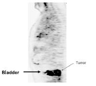 ADVANTAGES Images cellular metabolic changes of cancer prior to structural changes Detect primary and metastatic disease Assess tumor response to chemoradiation DISADVANTAGES Uptake in bladder,other