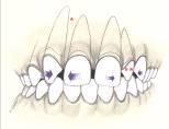 29 Spacing of Teeth Hereditary examples of tooth-size, jaw-size discrepancies that result in spacing.
