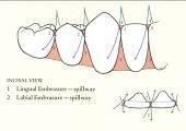 favorable axial inclinations of all the teeth, enhance dental health. Dental Disease Malocclusion can contribute to dental decay and periodontal disease.