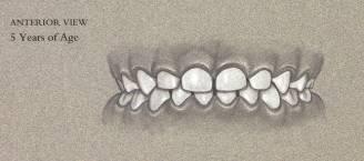 parafunction function demanded of the teeth and jaws outside the norm (i.e. bruxism) retainer - an appliance used for maintaining the positions of the teeth and jaws after orthodontic treatment.