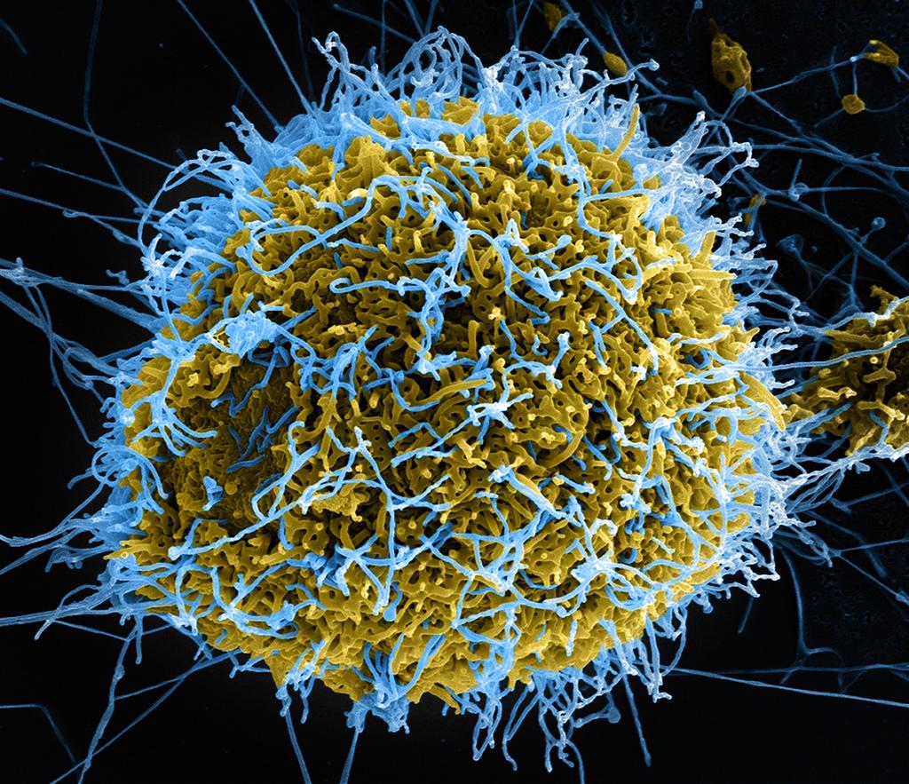 Image of Ebola viruses exiting host cells HUMAN