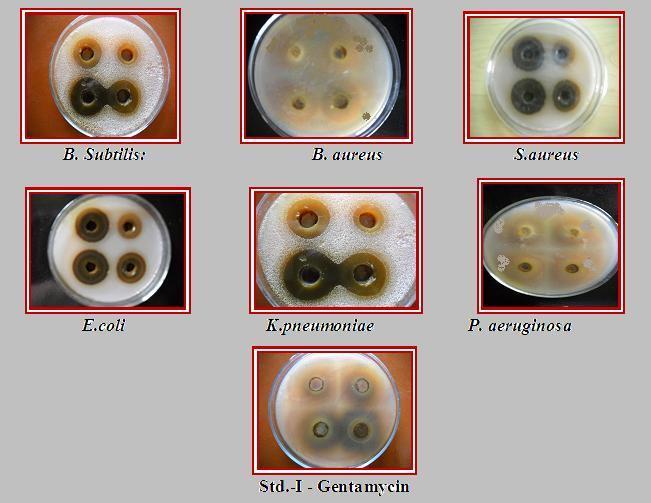 Table 1. Preliminary screening for antibacterial activity of aqueous bark extract of Bombax ceiba Test samples Aqueous bark Extract Gentamicin Conc.