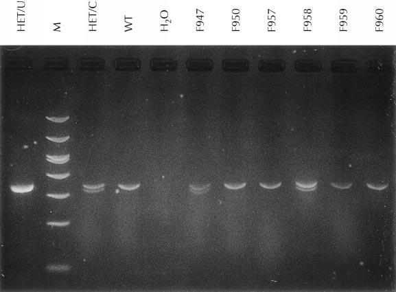 Figure. Case. Agarose gel electrophoresis for detection of the prothrombin mutation by polymerase chain reaction and HindIII restriction fragment length polymorphism.