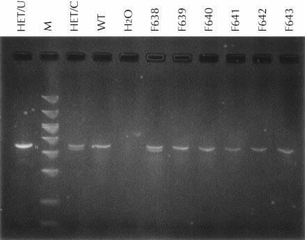 pair [bp] band); X74, molecular size marker; 373, wild-type control (63-bp band); F3, heterozygous control (- bp and 63-bp bands); F67 F638, patients Ds; and H O, negative (no-d) control.