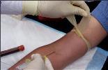 assays (IGRAs) are blood tests that measure a person s immune reactivity to TB