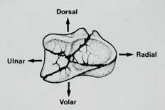 including the lunate fossa and sigmoid notch Ulnar Column Ulnar head, including the triangular fibrocartilage