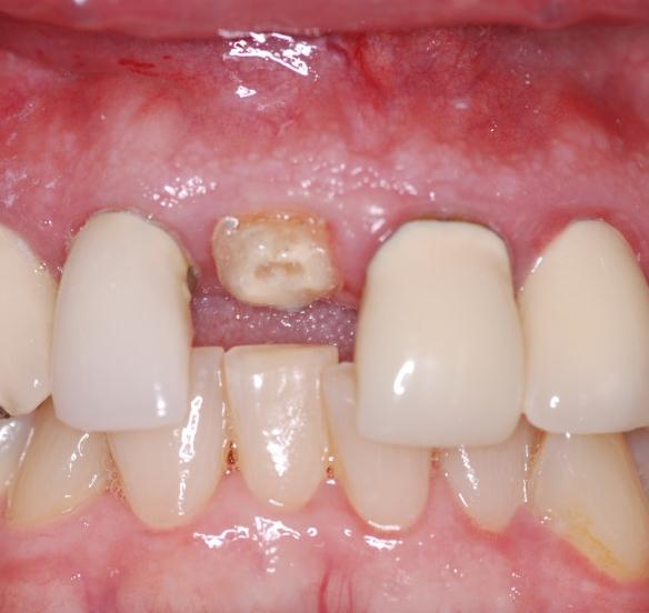 Pre-operative buccal view shows a