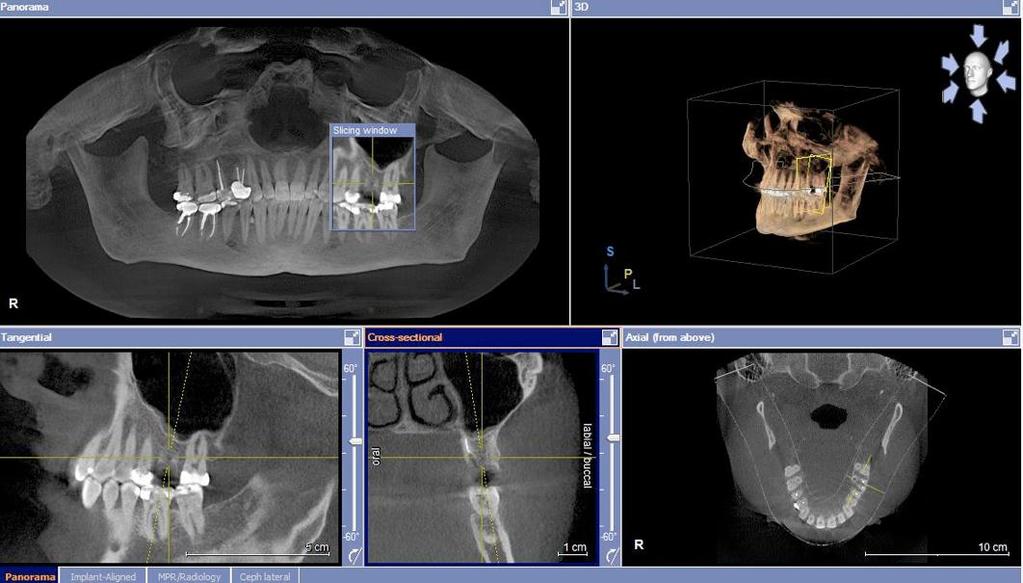 Dr. Edgard El Chaar CAT Scan of patient with the following views, Panoramic, 3-D, Tangential, Cross section and Occlusial.