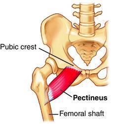Pectineus The pectineus muscle is a flat muscle that forms the base of the femoral triangle.