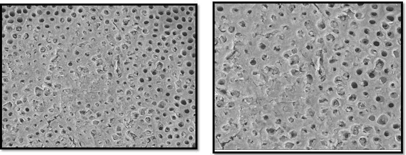 Figure 5b: GROUP 2 2B: TWO WEEK NOVAMIN SEM Micrographs of the dentine surface