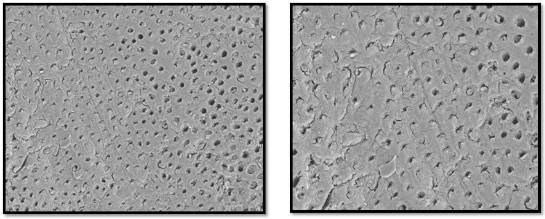 Figure5c: GROUP 2C THREE WEEK NOVAMIN SEM Micrographs of the dentine surface