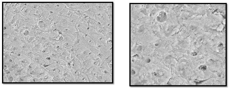 Figure 6c: GROUP 3C THREE WEEK LASER SEM Micrographs of the dentine surface