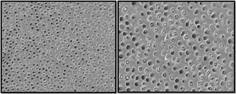 994 SEM Micrographs of the dentine surface morphology group at 1500X (left) and 3000X (right) magnifications in