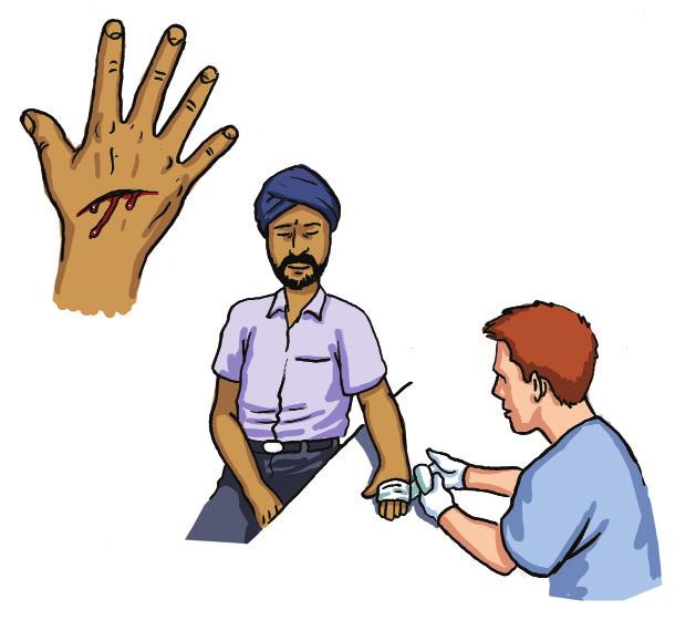 Minor injuries clinic Small cuts Infected cuts Minor burns Sprains If you need care for a small injury, go to the minor injuries clinic at the Western General Hospital.