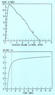 Basic Spirometry Interpretation Algorithm FEV₁/FVC% Normal? Obstruction No (<LLN) Yes Yes Normal FVC Normal?