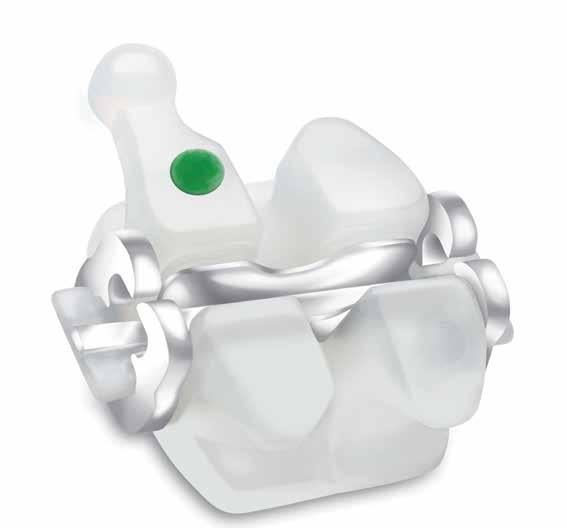 stage, from patient consultation on through to debonding, Clarity SL Self-Ligating Brackets are designed to empower you and your staff.