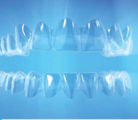 attachments for mesio-distal root tip control