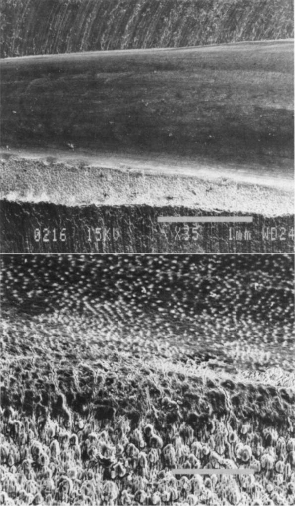 Fig. 1. -Above. Scanning electron photomicrographs showing tightly adherent smear layer and well developed fin adjacent to main canal. x 35.