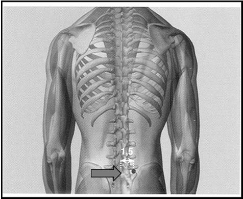 ½" to either side of the spine, in the low back.