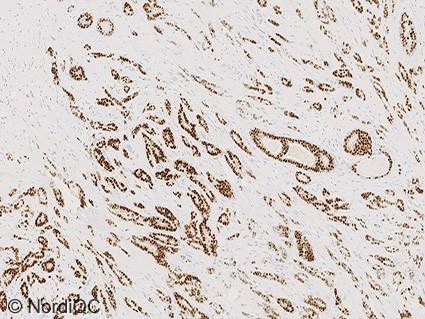 Positive staining reaction of the stromal cells in breast tissue indicates that a highly sensitive protocol is being applied, whereas the sensitivity cannot be evaluated in normal epithelial cells in