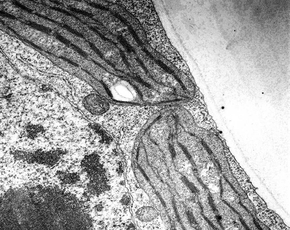 7 3. (a) The electron micrograph shows a section through two chloroplasts. C A B D W10 1074 01 7 Using the letters on the electron micrograph, complete the following table.