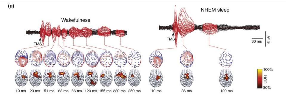 3) Connectivity between brain regions TMS combined