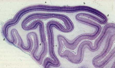 V1 is also called Striate (striped) cortex 20 http://neuro.med.