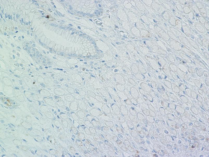 magnification view 40) of signet ring cell components