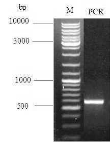 Figure 3.Amplified Internal Transcribed Spacer (ITS) sequence (ITS1 5.8S rdna-its4 region) from total genomic DNA of isolated causal fungus.