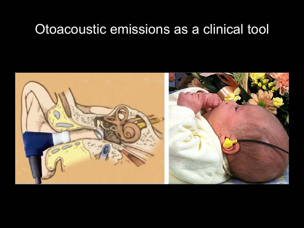 Otoacoustic emissions are a useful clinical tool, enabling tests for