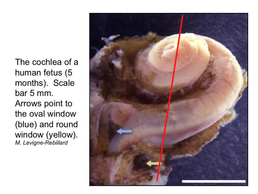 Structure and Function of the Auditory and Vestibular System - 1 Example of the human cochlea obtained from a 5 month old fetus.