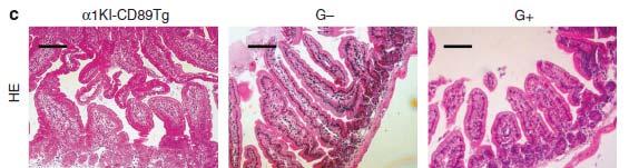 Gluten free diet for 3 generations reduction in IgA1 mesangial deposition glomerular inflammatory-cell infiltration IgA1 scd89 complexes in serum and kidney eluates hematuria