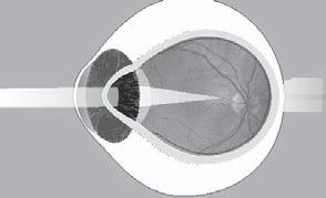 The eye works in much the same way as a camera Optic nerve (goes to brain) lenses cornea light light pupil lens film sclera retina THE CAMERA THE EYE A HEALTHY RETINA The macula is responsible for
