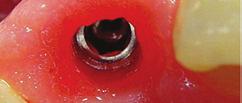 ability to manage properly the soft tissue profile around dental