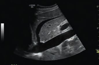 Agile Acoustic Ultrasound: XDclear transducer technology: the LOGIQ E9 powerful architecture overcomes the traditional rigid assumptions, showing a flexible ultrasound approach built on proprietary