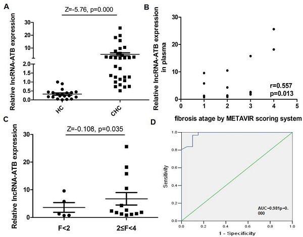 Total area under the curve for lncrna-atb was 0.98 (P=0.000)(Fig. D), which suggested that lncrna-atb had adequate sensitivity and specificity to predict the degree of liver fibrosis in HCV patients.