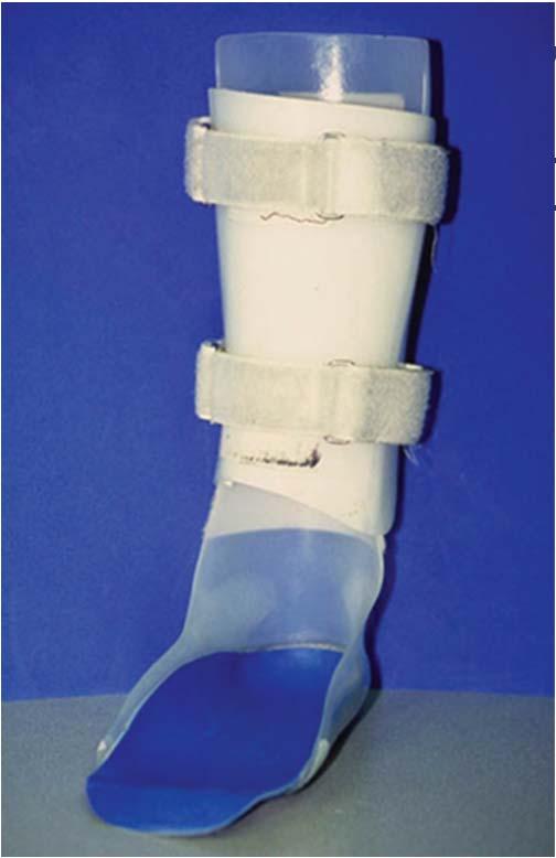 Solid AFO w/ foot orthosis Double upright