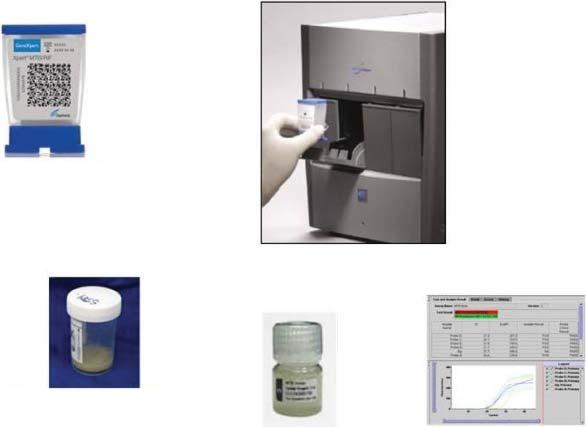 Concentrates bacilli and removes inhibitors End of hands-on work Sample is automatically filtered and washed 4 Ultrasonic lysis of filtercaptured organisms to release DNA 3 5 DNA is mixed with dry