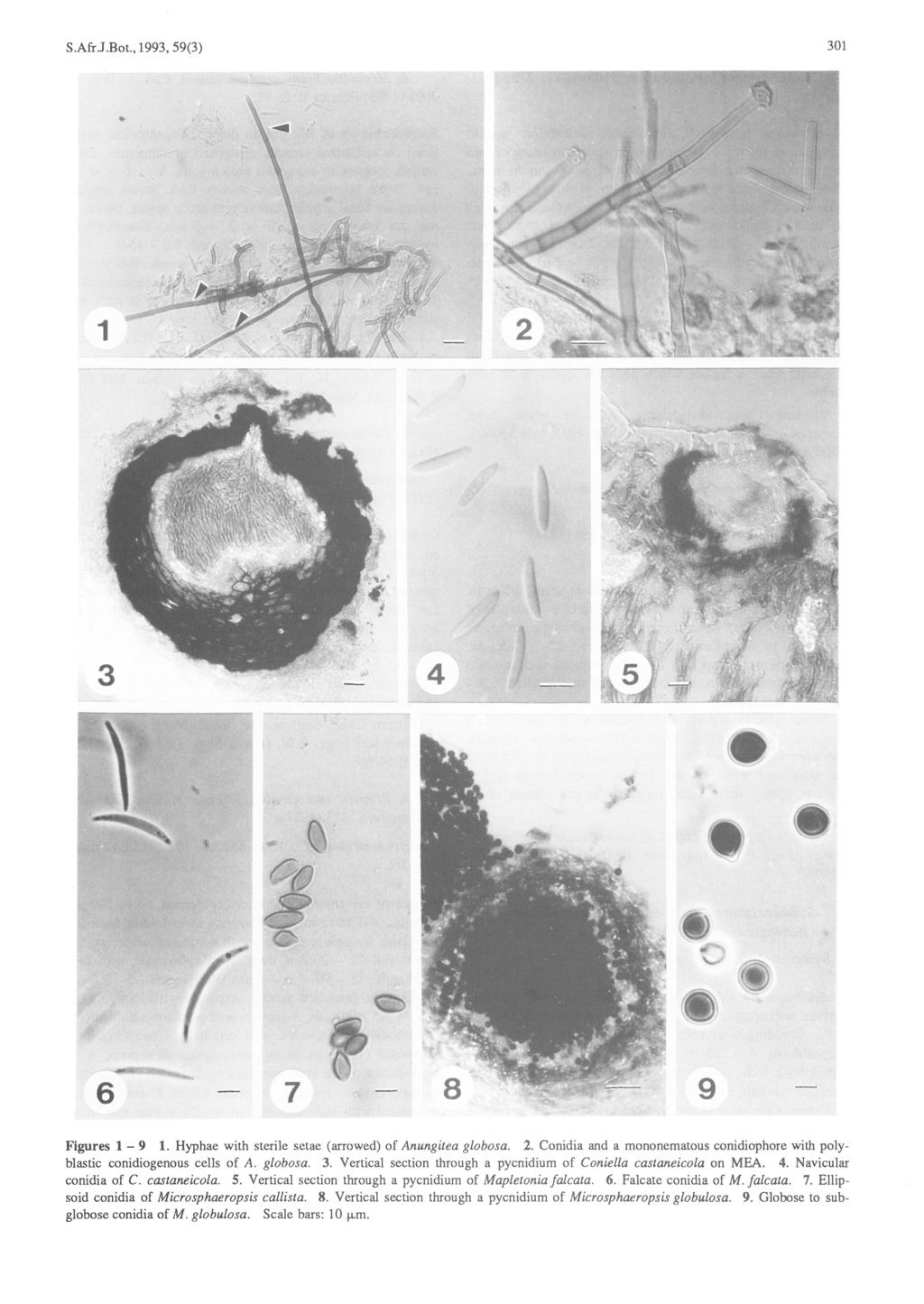 301 S.Afr.J.Bot.,1993,59(3) 6 7 Figures 1-9 1. Hyphae with sterile setae (arrowed) of Anungitea globosa. 2. Conidia and a mononematous conidiophore with polyblastic conidiogenous cells of A. globosa. 3.